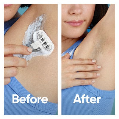 Venus Extra Smooth Sensitive Value Pack Women's Razor + 3 Razor Blade Refills - Imperfect Box