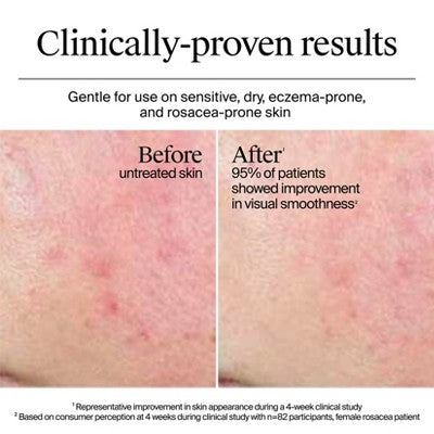 Neutrogena Hydro Boost Water Face Cream for Extra-Dry and Acne-Prone Skin 0.5 fl oz - Imperfect Box