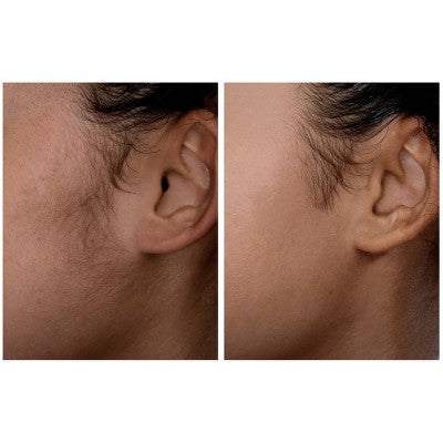 Spa Sciences SIMA Dermaplaning Replacement Safety Tips 6ct - New