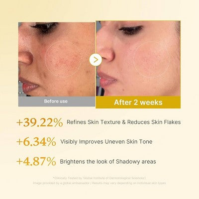 medicube Korean Skincare Kojic Acid Turmeric Resurfacing Face Toner 250ml - Imperfect Box