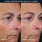 RoC Retinol Correxion Line Smoothing Peel Pads 20ct - Missing Box