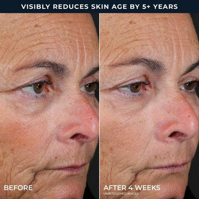 RoC Retinol Correxion Line Smoothing Peel Pads 20ct - Missing Box