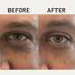 Papatui Ageless Action Technology Under Men's Eye Patch 6ct - Imperfect Box