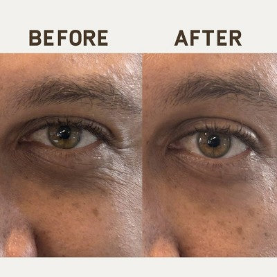 Papatui Ageless Action Technology Under Men's Eye Patch 6ct - Imperfect Box