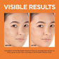 L'Oreal Paris Revitalift 12% Vitamin C + E + Salicylic Serum 1 fl oz - Imperfect Box