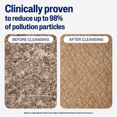 Cetaphil Gentle Clear Salicylic Acid Acne Pore Cleanser 8 fl oz - New