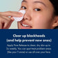 Hero Pore Release 100ml - Imperfect Box
