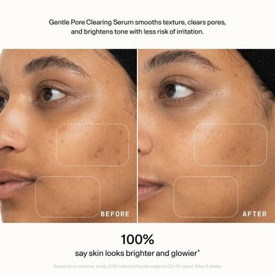 Versed Skin Refine Gentle Pore Clearing Serum 1 fl oz - Imperfect Box