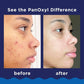 PanOxyl 10% Benzoyl Peroxide Acne Foaming Wash 5.5oz - Imperfect Box