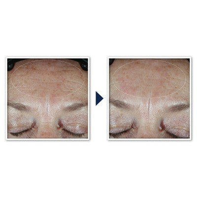 RoC Multi Correxion Hydrate + Plump Daily Moisturizer with Hyaluronic Acid SPF 30 1.7oz - Imperfect Box