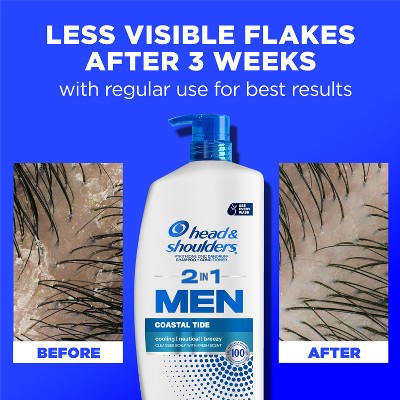 Head & Shoulders Men's 2-in-1 Shampoo and Conditioner, Anti-Dandruff Treatment, Full Thick for Daily Use, Paraben-Free 28.2 fl oz - Imperfect Container