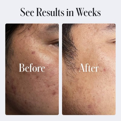 Geologie Clear System Clear Skin Face Cream 2 fl oz EXP 05/2026 - New