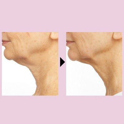 No7 Restore & Renew Multi Action Face & Neck Serum 1.69 fl oz - Imperfect Box
