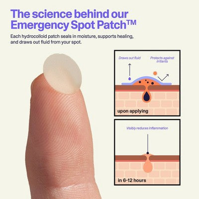 Curology Emergency Spot Facial Pimple Patches 80ct - Imperfect Box