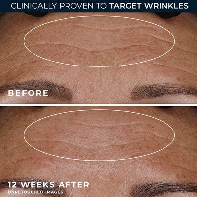 RoC Retinol Anti-Aging + Firming Night Face Moisturizer 1 fl oz - Imperfect Box