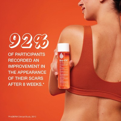 Bio-Oil Body Oil and Scar Treatment with Vitamin E 6.7 fl oz - Missing Box