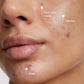 Neutrogena Evenly Clear Acne Cleansing Mask with Benzoyl Peroxide 4.2 fl oz - Imperfect Box