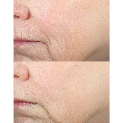 derma e Advanced Peptides & Collagen Serum 2 fl oz - New