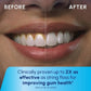 Waterpik Cordless Water Flosser - Imperfect Box
