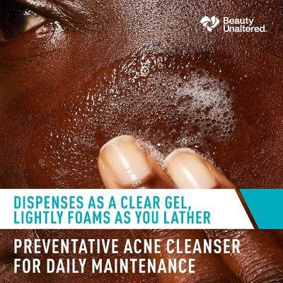 CeraVe Acne Face Cleanser 2% Salicylic Acid; Purifying Clay Oily Skin 16 fl oz - Imperfect Container