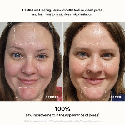 Versed Skin Refine Gentle Pore Clearing Serum 1 fl oz - Imperfect Box