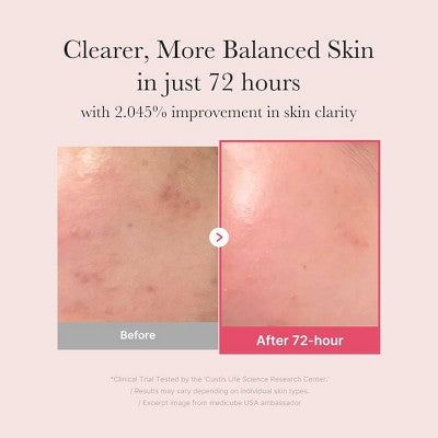 medicube Niacinamide Serum Korean Skincare 1.01 fl oz - Imperfect Box