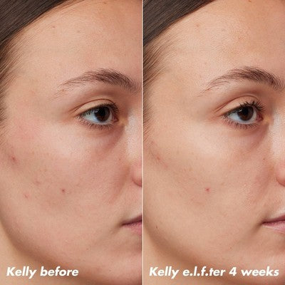 e.l.f. SKIN PLZ Clarify Facial Oil 2% Salicylic Acid Acne Treatment + Aloe Extract 1 fl oz - Imperfect Box