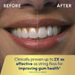 Waterpik Ultra Water Flosser - Imperfect Box