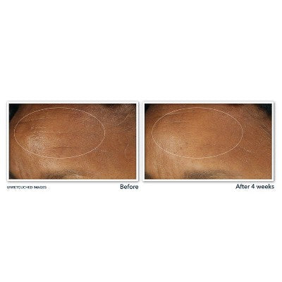 RoC Retinol Correxion Deep Wrinkle Moisturizer SPF 30 1 fl oz - Imperfect Box