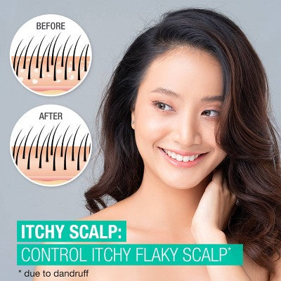 Neutrogena Scalp Therapy Itchy Scalp Shampoo 12 fl oz - Imperfect Container
