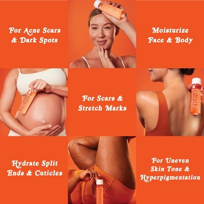 Bio-Oil Body Oil and Scar Treatment with Vitamin E 6.7 fl oz - Missing Box