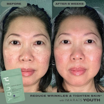 Imarais Beauty Youth Anti-Aging Gummies Vegan and Sugar-Free 30ct - Imperfect Container