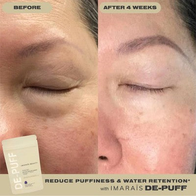 Imarais Beauty De-Puff Anti-Bloat Gummies Vegan and Sugar-Free 30ct - Imperfect Container