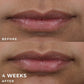 RoC Derm Correxion Lip Volumizer Treatment 0.34 fl oz - Imperfect Box