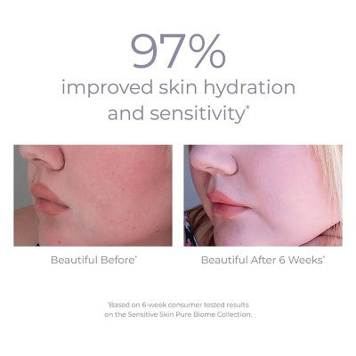 derma e Pure Biome Face Cleanser 6 fl oz - New