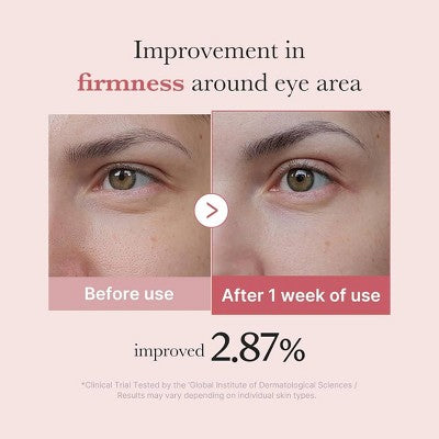 medicube PDRN Pink Peptide Eye Serum Korean Skincare 30ml - Imperfect Box