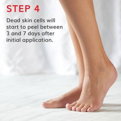 Baby Foot Original Exfoliation Foot Peel Lavender 2.4 fl oz - Imperfect Box