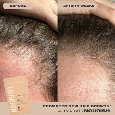 Imarais Beauty Nourish Haircare Gummies Vegan and Sugar-Free 30ct - Imperfect Container