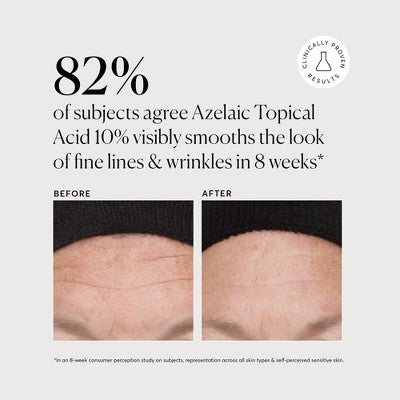 Naturium Azelaic Topical Acid 10% Jumbo 2.0 fl oz - Missing Box