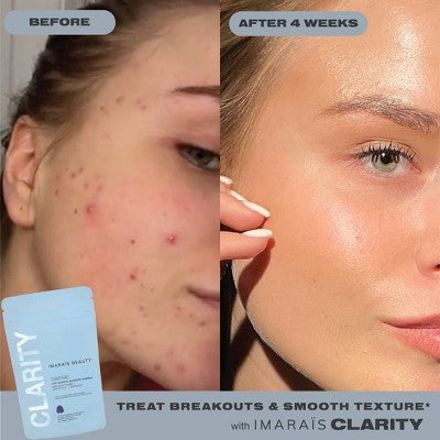 Imarais Beauty Clarity Anti-Blemish Gummies Vegan and Sugar-Free 30ct - Imperfect Container