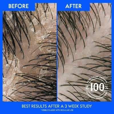 Head & Shoulders Dry Scalp Care Daily-Use Anti-Dandruff Paraben Free Conditioner 10.9 fl oz - Imperfect Container