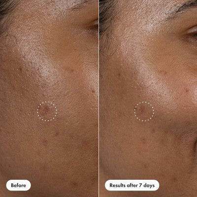 Hero Cosmetics Dark Spot Correct 10ml - New