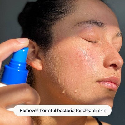 Magic Molecule Hypochlorous Acid Skin Spray 3.4oz/2ct - Missing Box