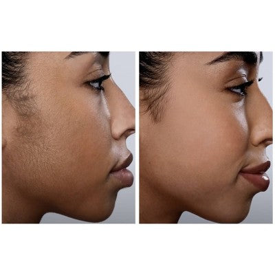 Spa Sciences SIMA Dermaplaning Replacement Safety Tips 6ct - New