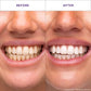 Hismile V34 Teeth Whitening Strips 14pk - Imperfect Box