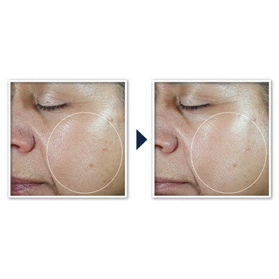 RoC Multi Correxion Even Tone + Lift 5-in-1 Daily Moisturizer SPF 30 1.7oz - Imperfect Box