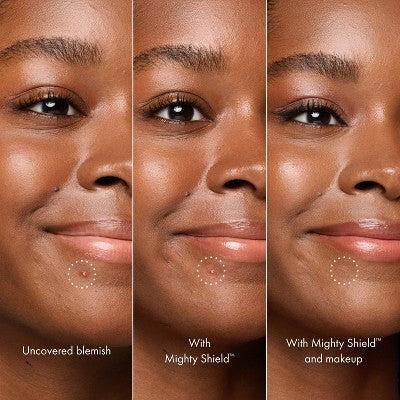 Hero Cosmetics Mighty Shield Liquid Patch Invisible Blemish Protectant 10ml - Imperfect Box