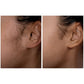 Spa Sciences SIMA Deluxe Sonic Dermaplaning Tool for Exfoliation & Peach Fuzz Removal - Imperfect Box