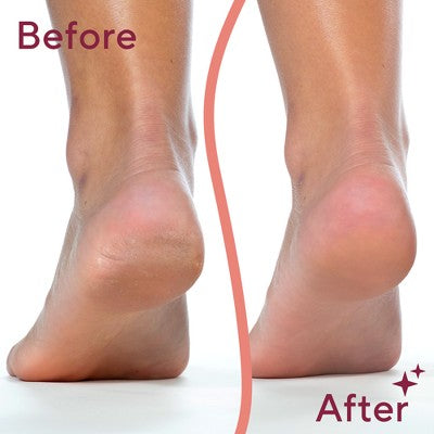 Finishing Touch Flawless Pedi - Imperfect Box