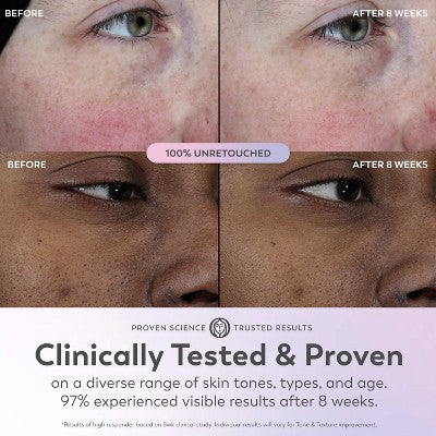 Olay Super Face Serum with Vitamin C 1 fl oz - Imperfect Box
